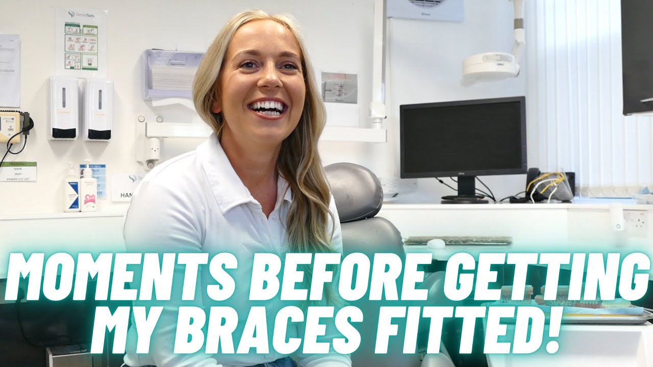 My SECOND time having braces... as an adult! | Six-month smile brace treatment | Ep 1