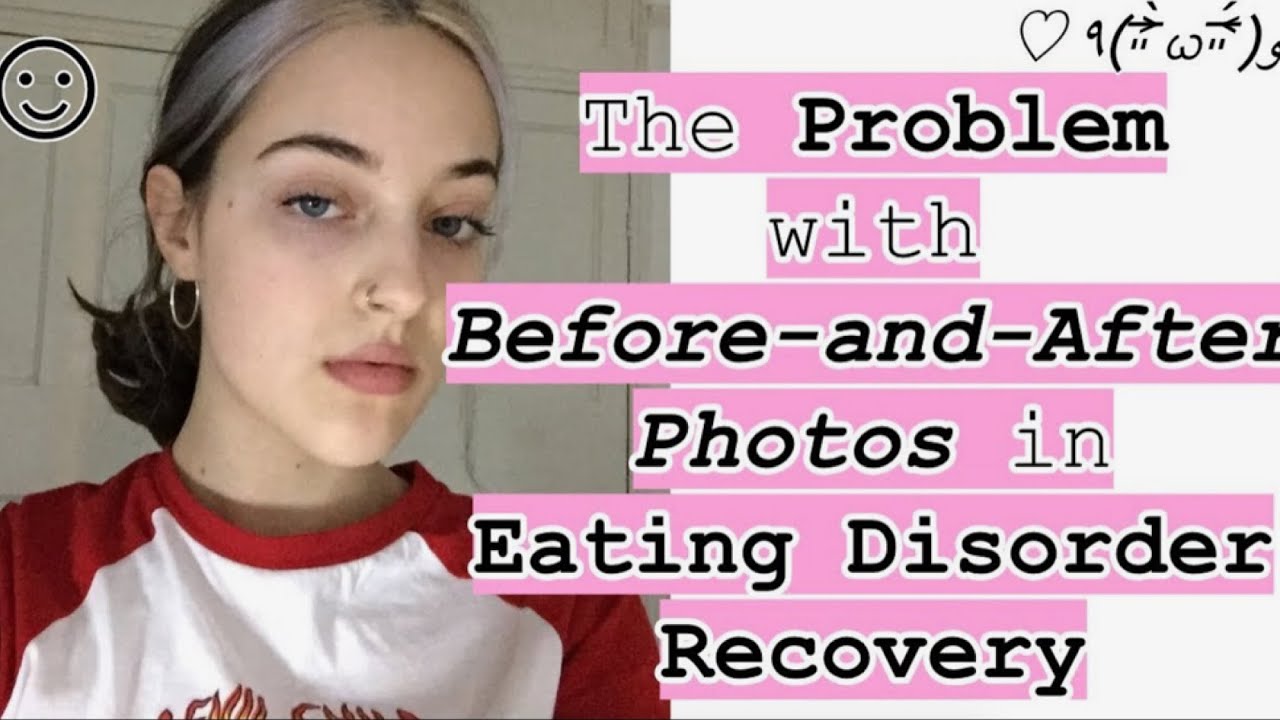 The Problem with Before-and-After Photos in Eating Disorder Recovery