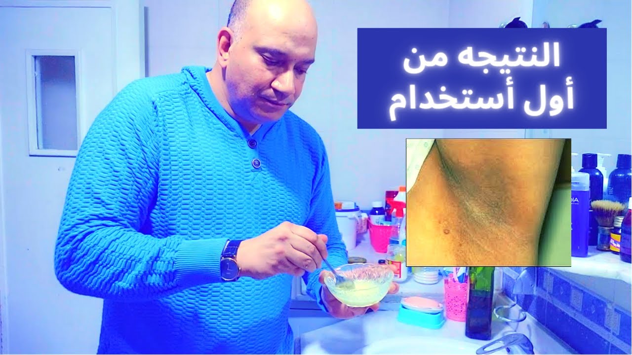 تفتيح وازاله المناطق السوداء بالجسم / نتيجه فوريه/ فاعليه الليمون والسكر وزيت الزيتون