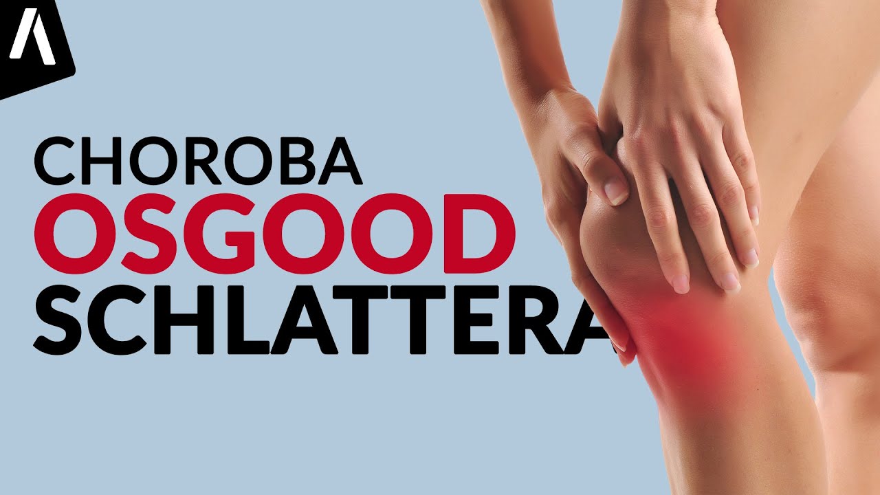 Choroba Osgood-Schlattera I Co warto o niej wiedzieć?