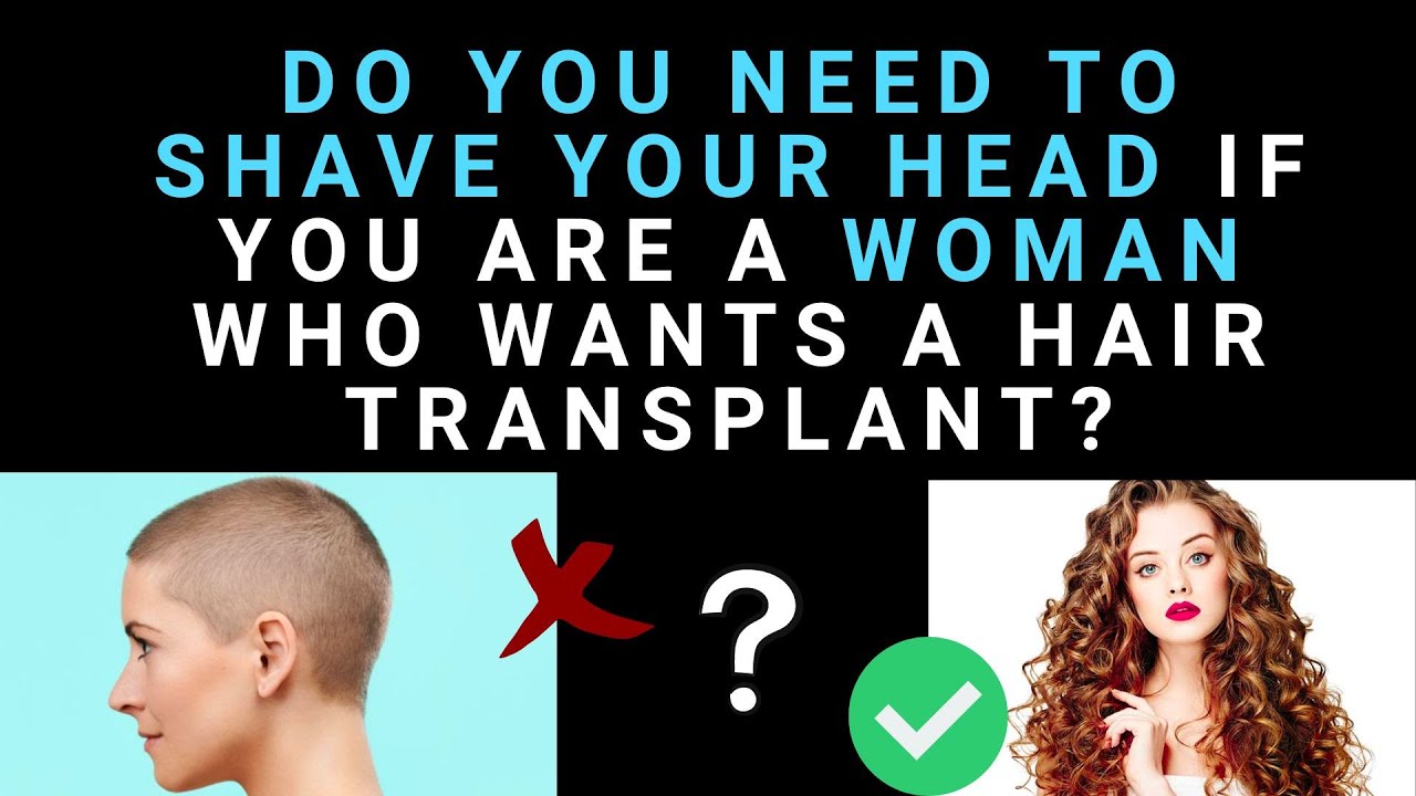 DO WOMEN NEED TO SHAVE FOR A HAIR TRANSPLANT?