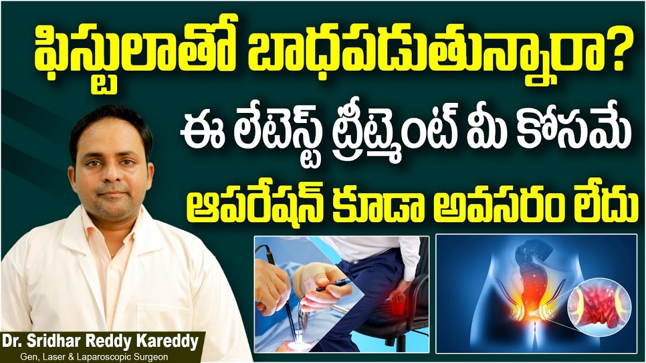 Best Treatment for Fistula || Fistula Laser Treatment in Hyderabad || Treatment Range Hospital