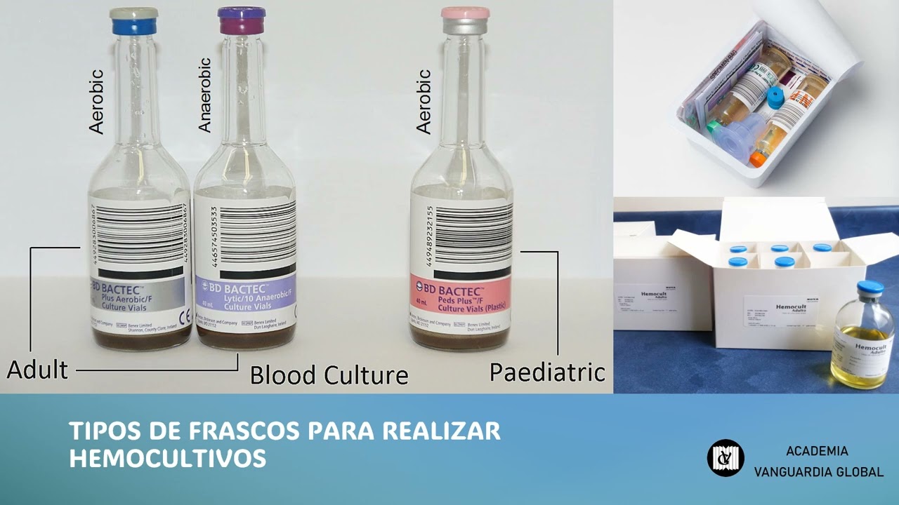 Toma de Muestra en Hemocultivos version 2024