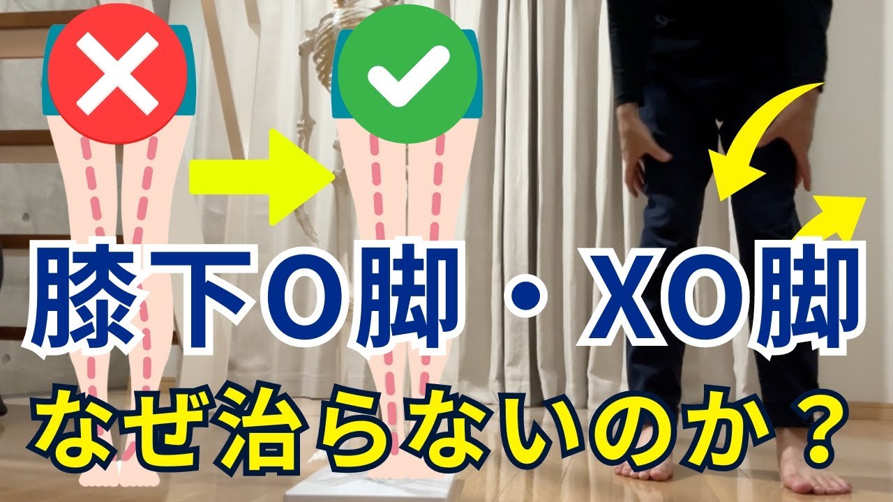 【この仕組みを知らないから治らない】「膝下O脚」「XO脚」はなぜ改善しないのか？大多数の人が知らない「膝下O脚・XO 脚」の仕組みと運動療法・セルフケア方法！