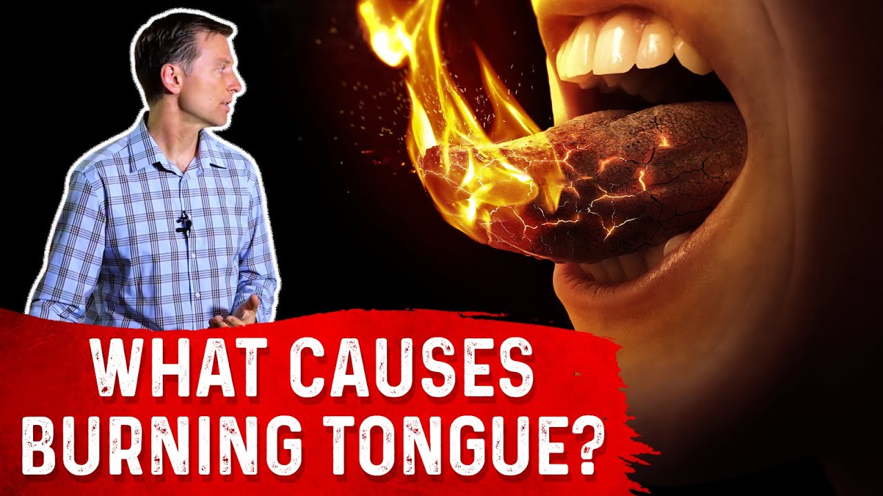 The Causes & Treatment of Burning Tongue (Mouth) &ndash; Dr. Berg