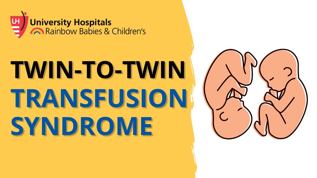 Twin to Twin Transfusion Syndrome