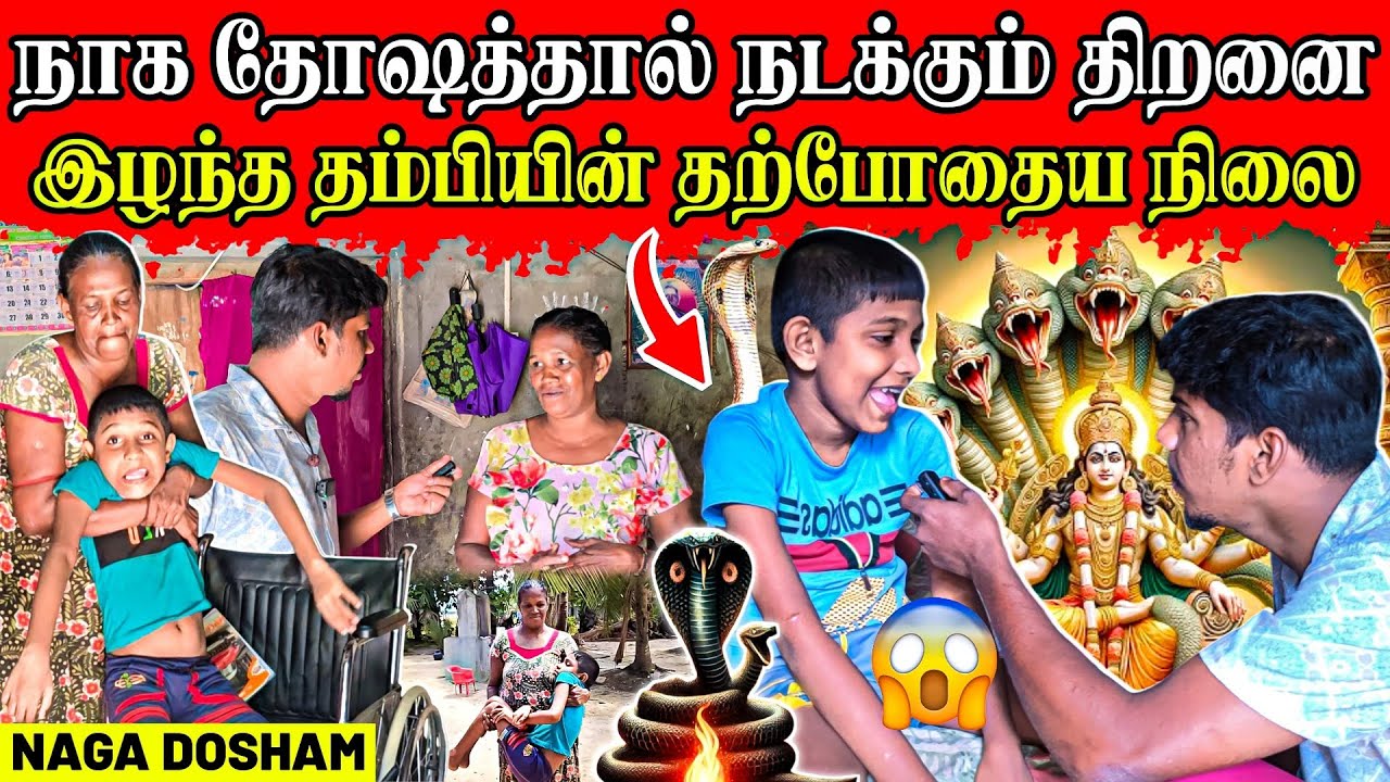 படிக்கும் வயதில் பாம்பால் பாதம் இழந்தேன் 😥 | இன்று என் நிலை இது தான் | Rj Tamizha