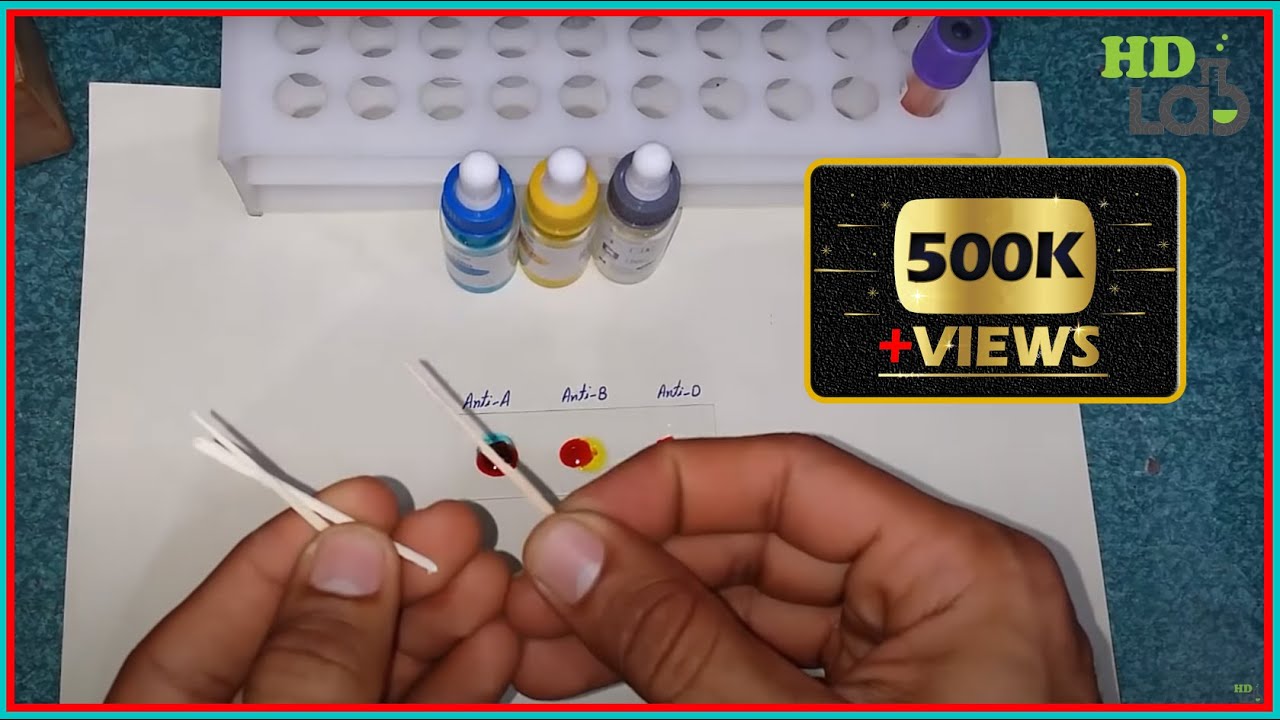 Blood Group Testing Experiment | Step-by-Step Guide at Harib Diagnostic Lab