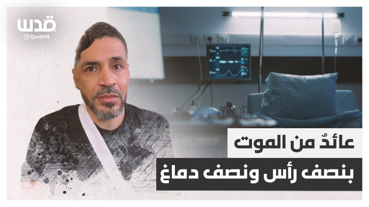 بنصف رأس ونصف دماغ.. أنس البشر من مخيم جنين يتحدث عن إصابته وعلاجه