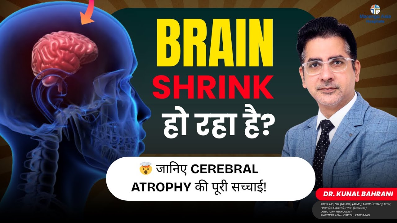 Is your brain shrinking? Know the whole truth about Cerebral Atrophy! | Cerebral Atrophy | Dr. Kunal
