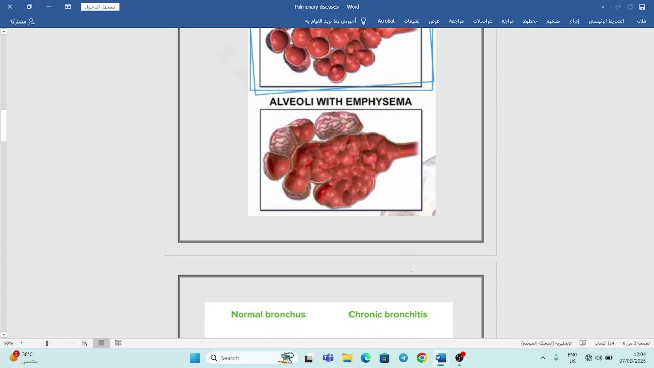 pulmonary disease