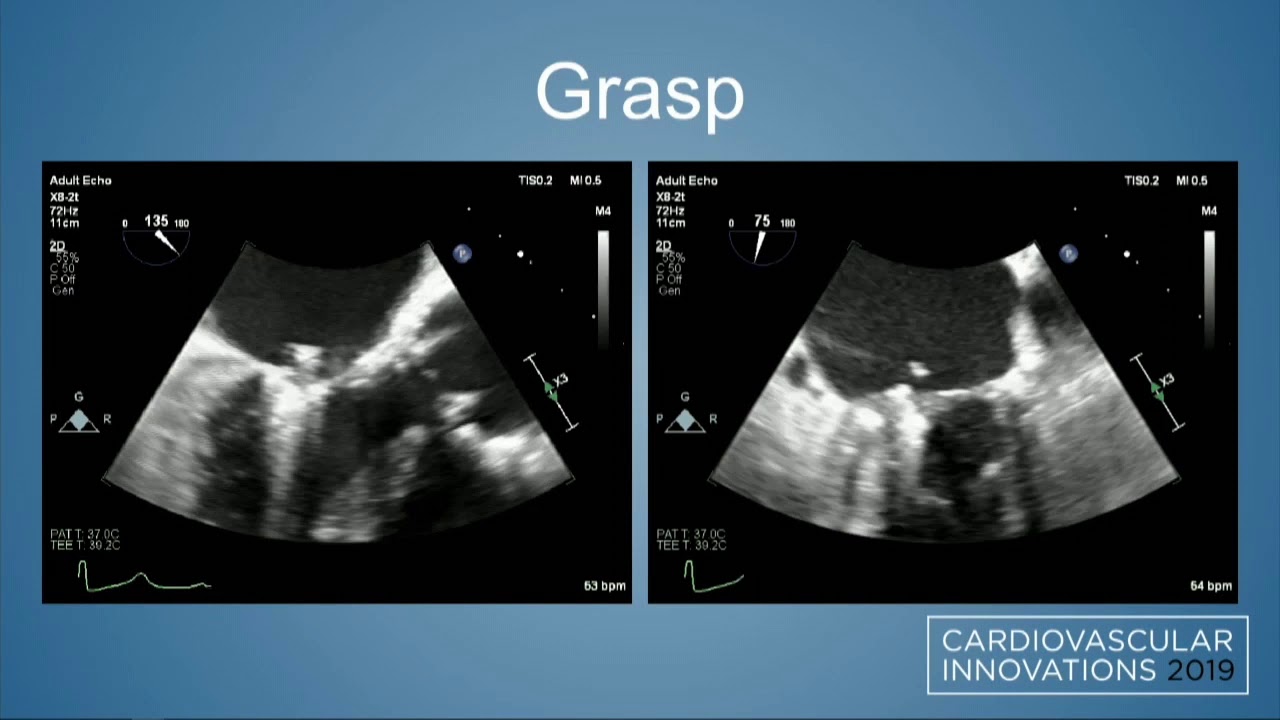 CVI 2019_Friday, 7/19_Structural Challenging Case Competition Semifinals_Daniel Feldman, MD