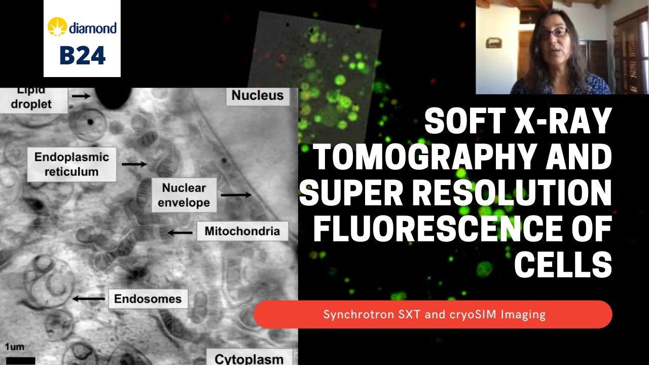 3D Correlative Cryoimaging using super resolution fluorescence microscopy and soft X-ray tomography