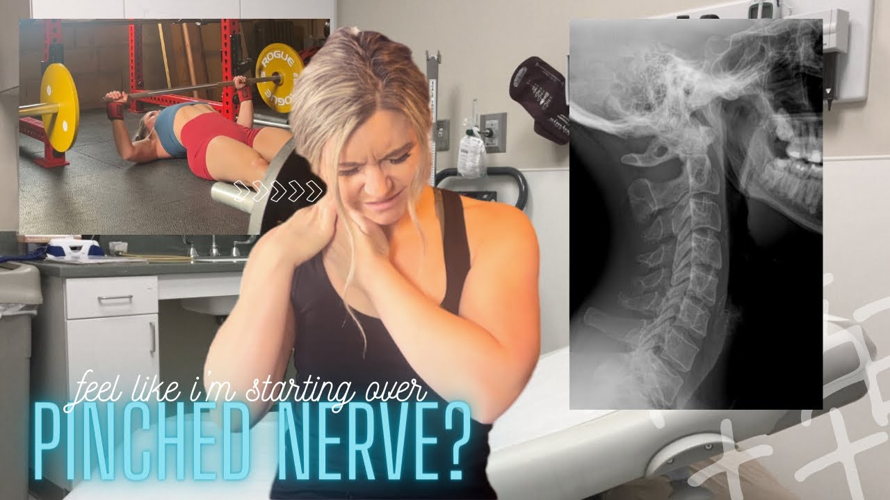 I Have A Pinched Nerve | Now What? | Still Lifting?