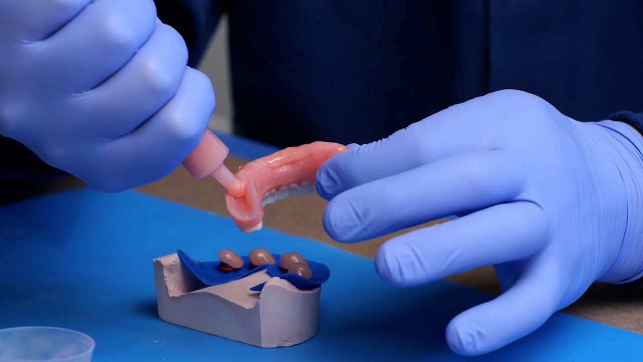 Section C: The Pickup | Chapter 1: Placing the Denture for Pickup - Smart Denture Conversions Traini