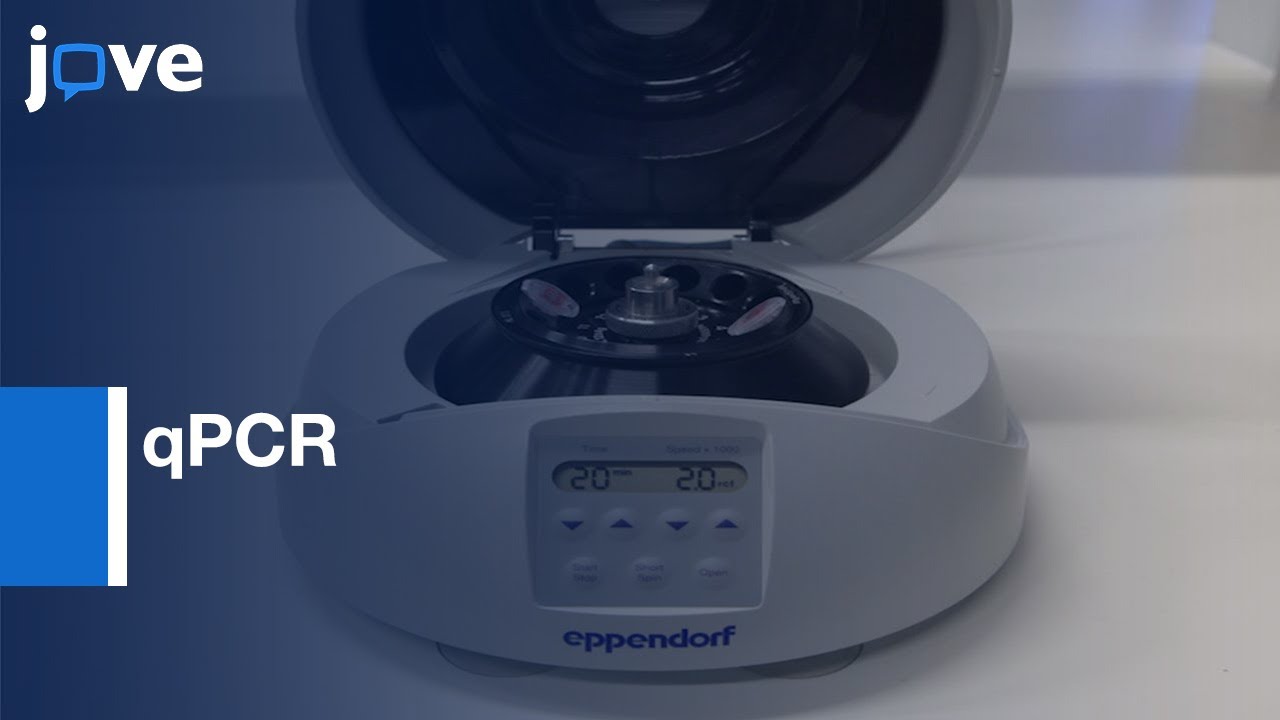 qPCR for Exosomal miRNA Analysis in NSCLC: A Biopsy Tool | Protocol Preview