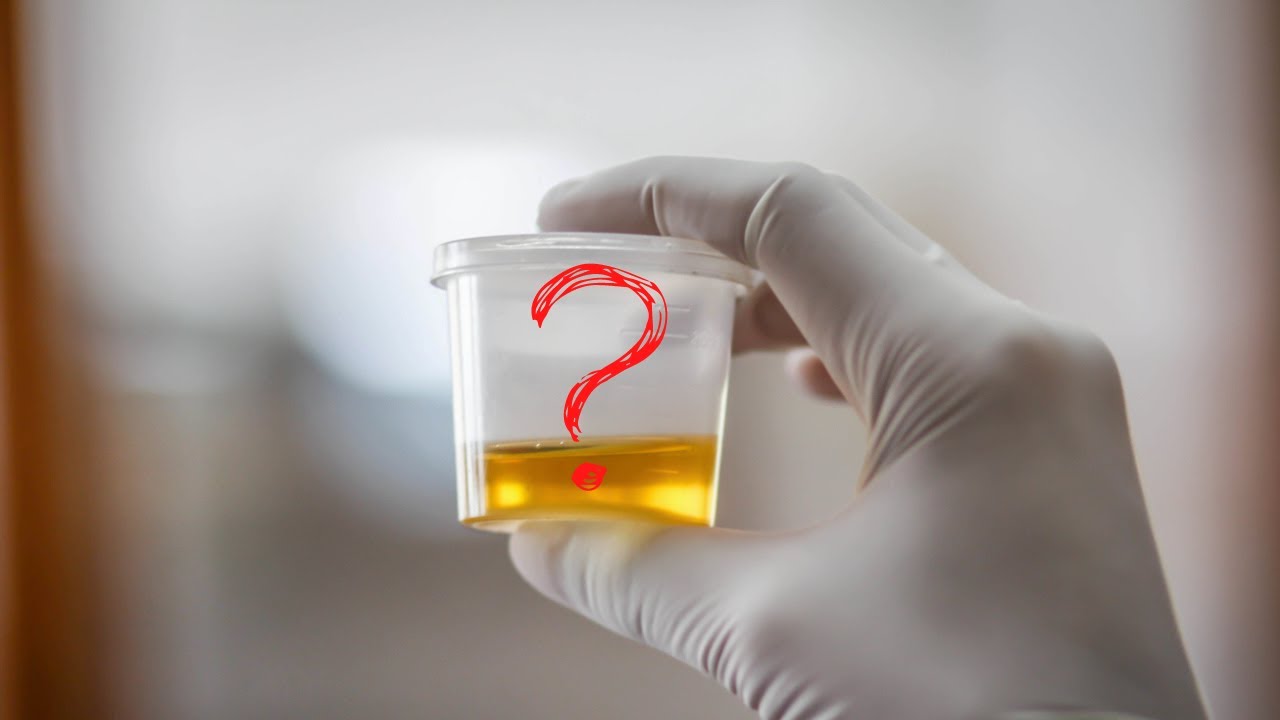 Does Suboxone Show Up on a Urine Test? - SuboxoneDoctor.com