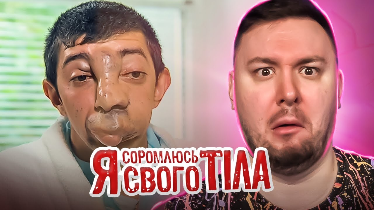 Я стесняюсь своего тела ► Что у него с лицом?