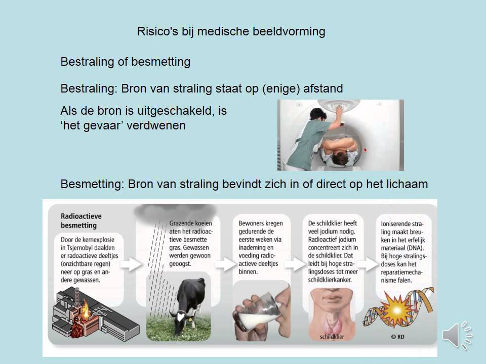 Risico's bij medische beeldvorming