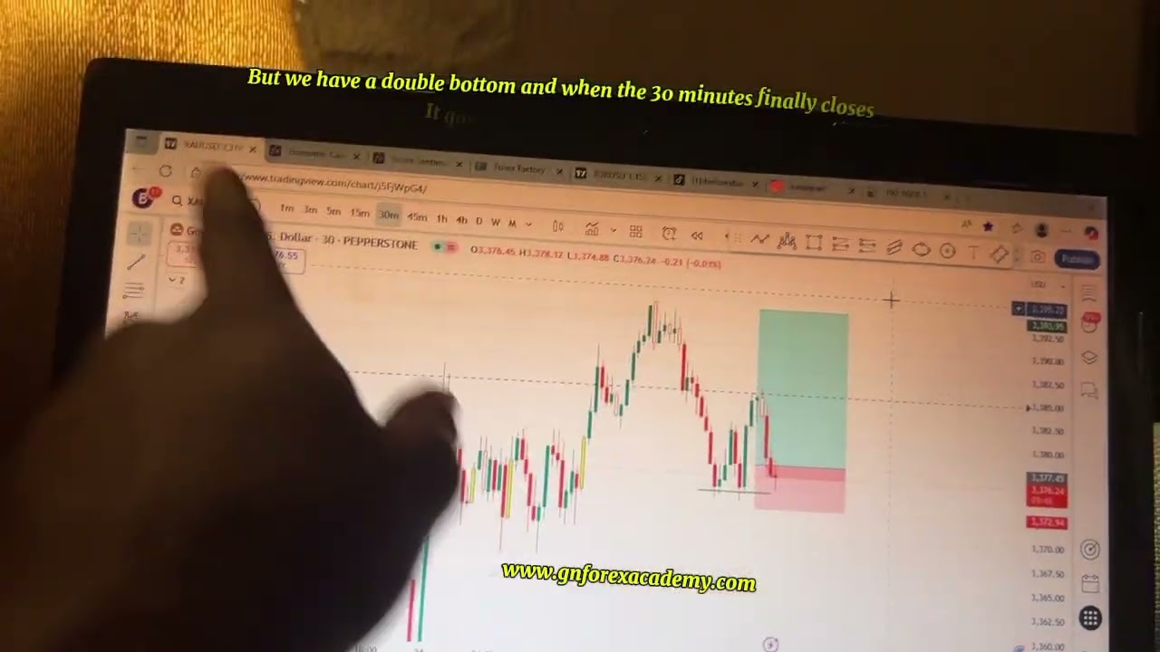 XAUUSD Analysis Today 📊 | Gold Trade Setup 🔥