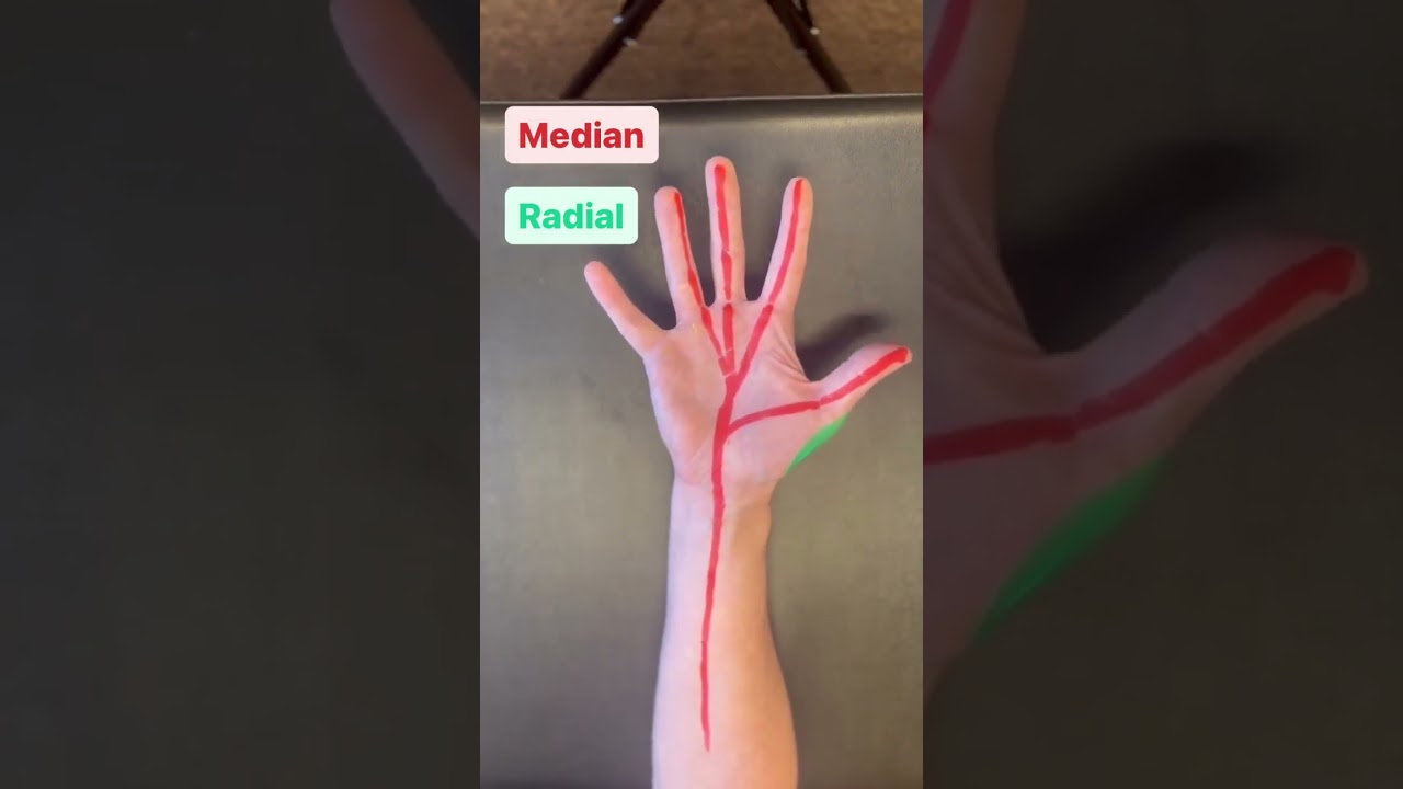 Является ли лучевой нерв причиной симптомов синдрома запястного канала?