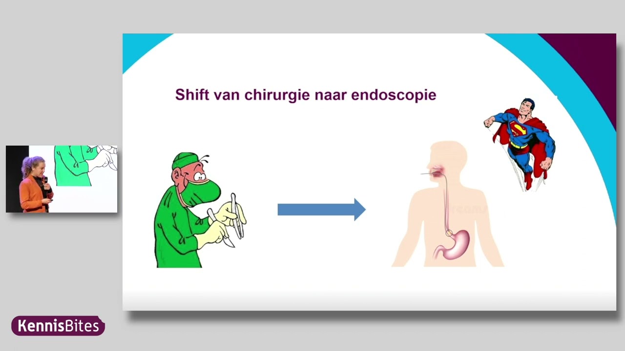 KennisBite: De optimale techniek om vroege kanker in een Barrett slokdarm met endoscopisch verwijder