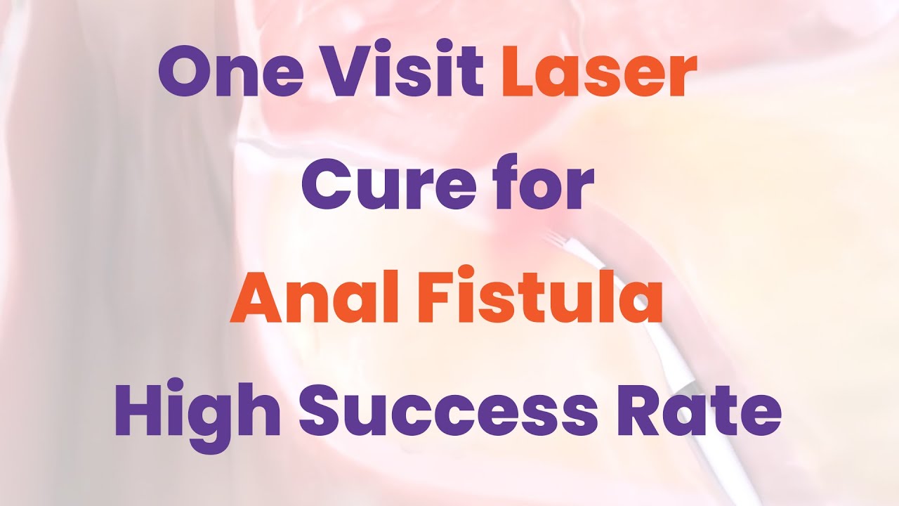Anal Fistula Treatment by Laser &ndash; Minimal Pain & Non-Surgical