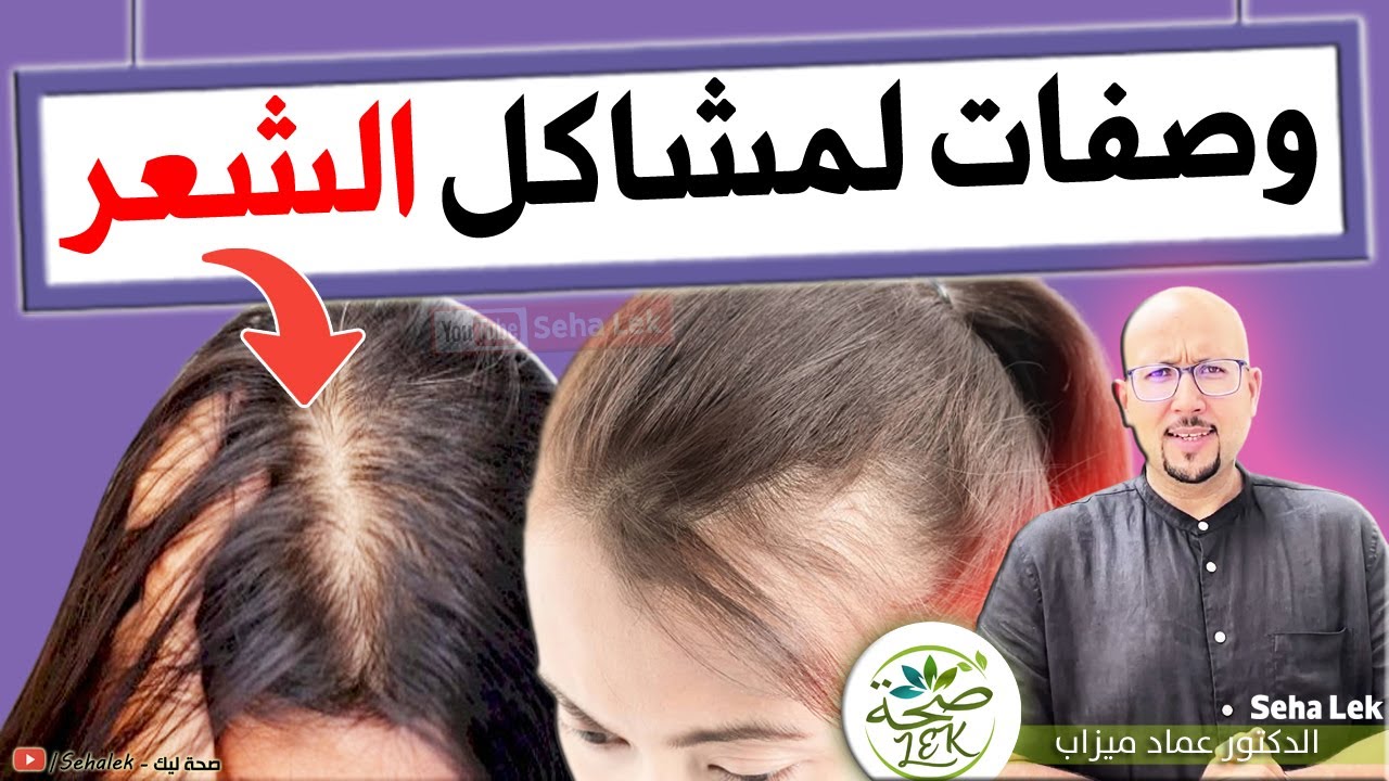 وصفات طبيعية لعلاج مشاكل الشعر وتساقط الشعر / Wasafata Dr Imad Mizab cheveux