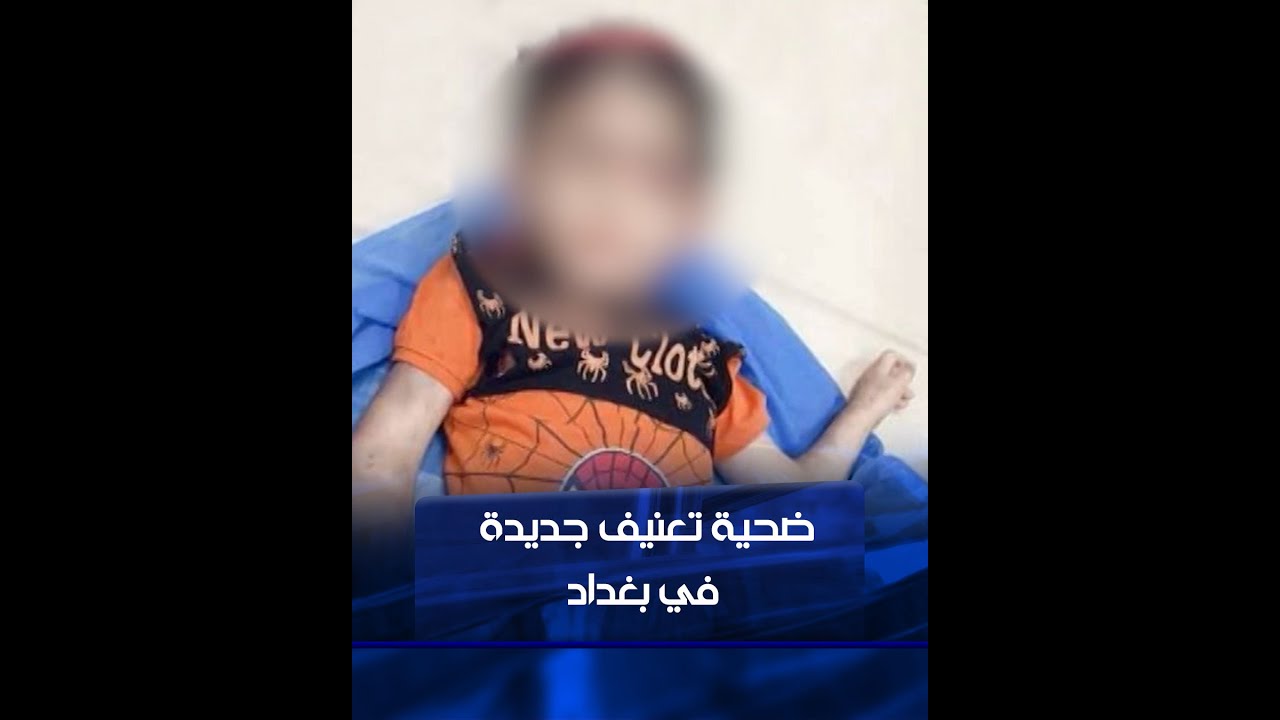 ضحية تعنيف جديدة ببغداد..الطفل حيدر يرقد في قسم العناية المركزة بعد أن ألقته زوجة أبيه من على السلم