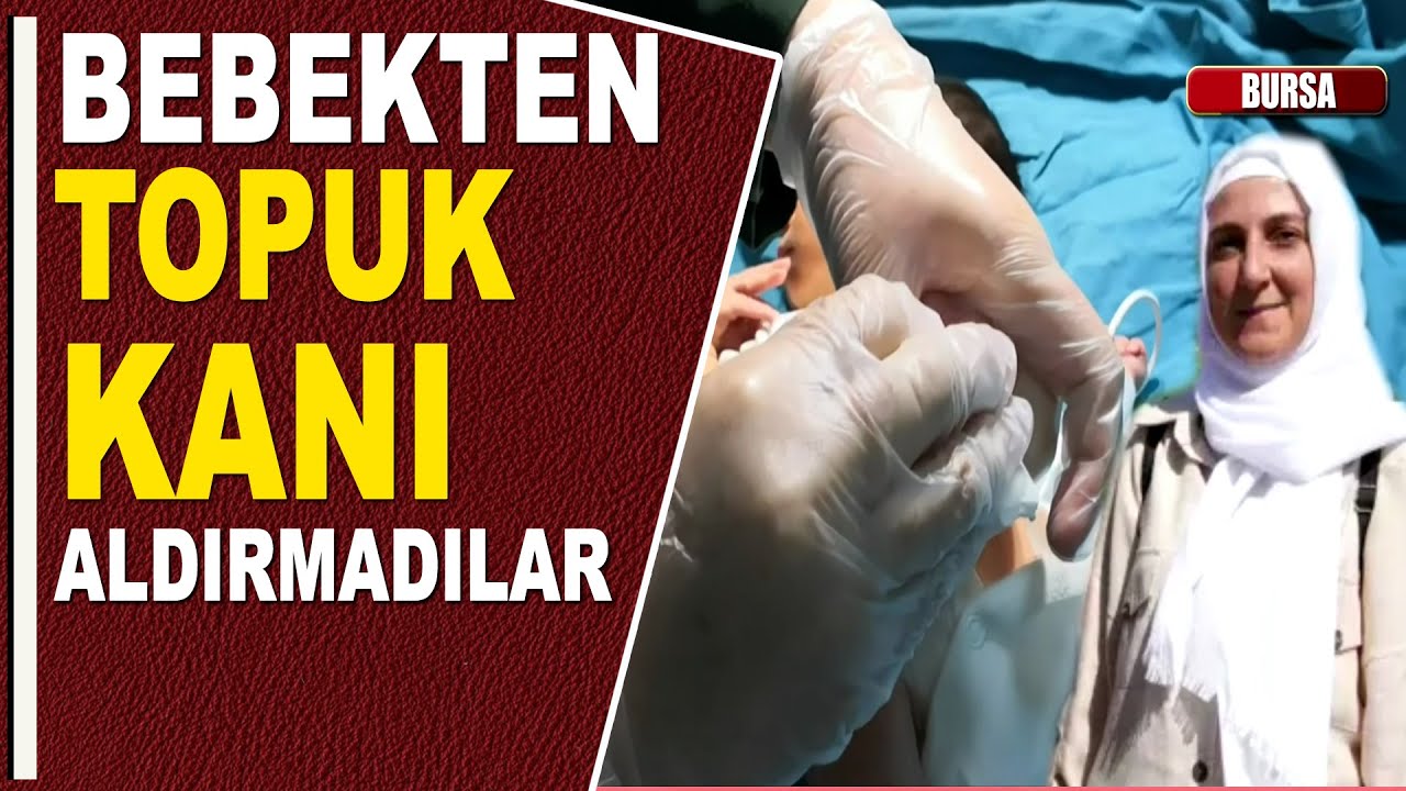 BEBEKTEN TOPUK KANI ALDIRMADILAR