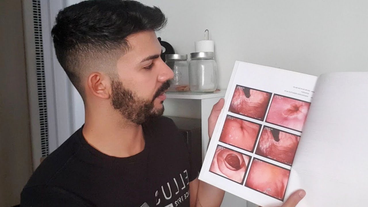 RESULTADO DA ENDOSCOPIA