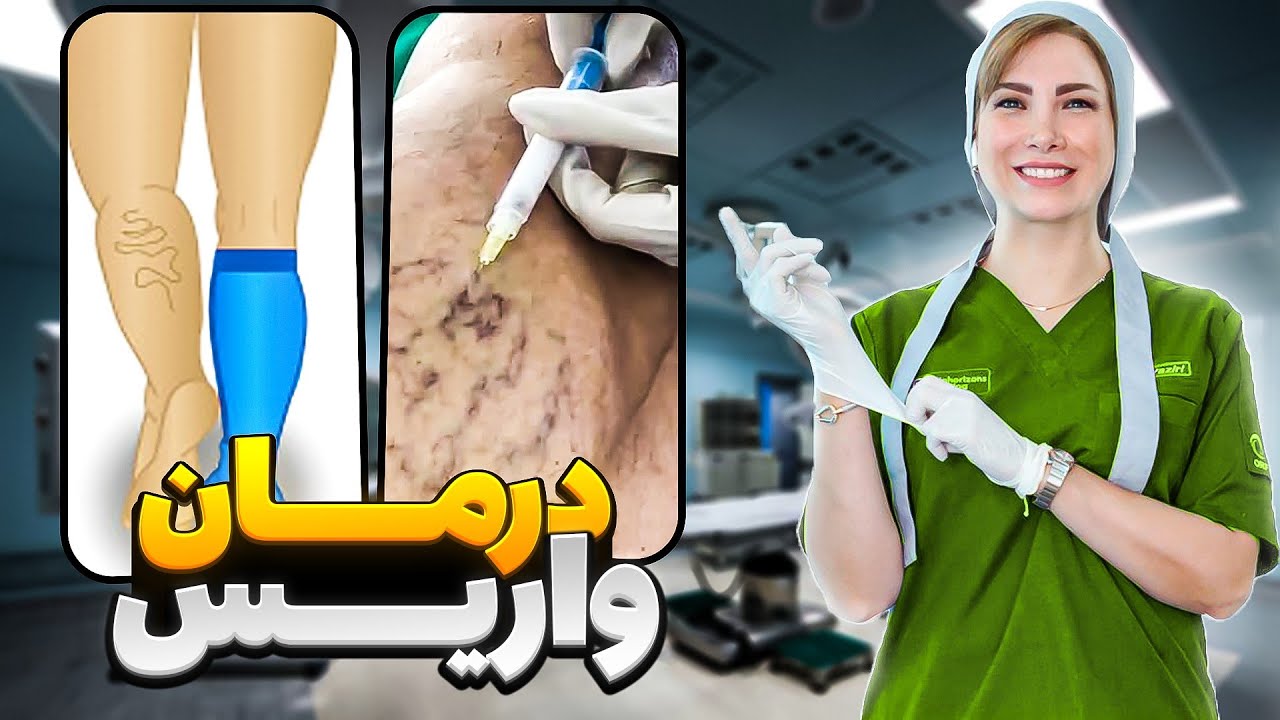راه های پیشگیری و درمان واریس پا