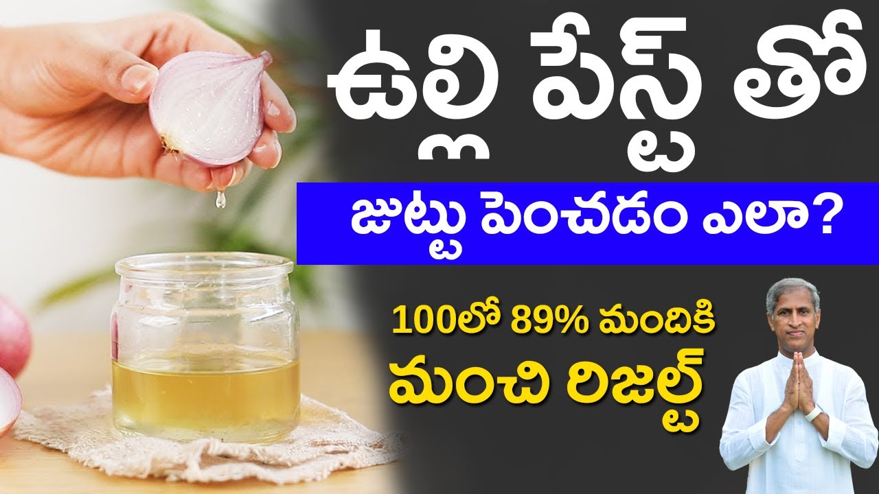 ఉల్లి పేస్ట్ తో జుట్టు పెంచడం ఎలా ? 100 లో 89% మందికి మంచి రిజల్ట్ | Dr Manthena Satyanarayana Raju