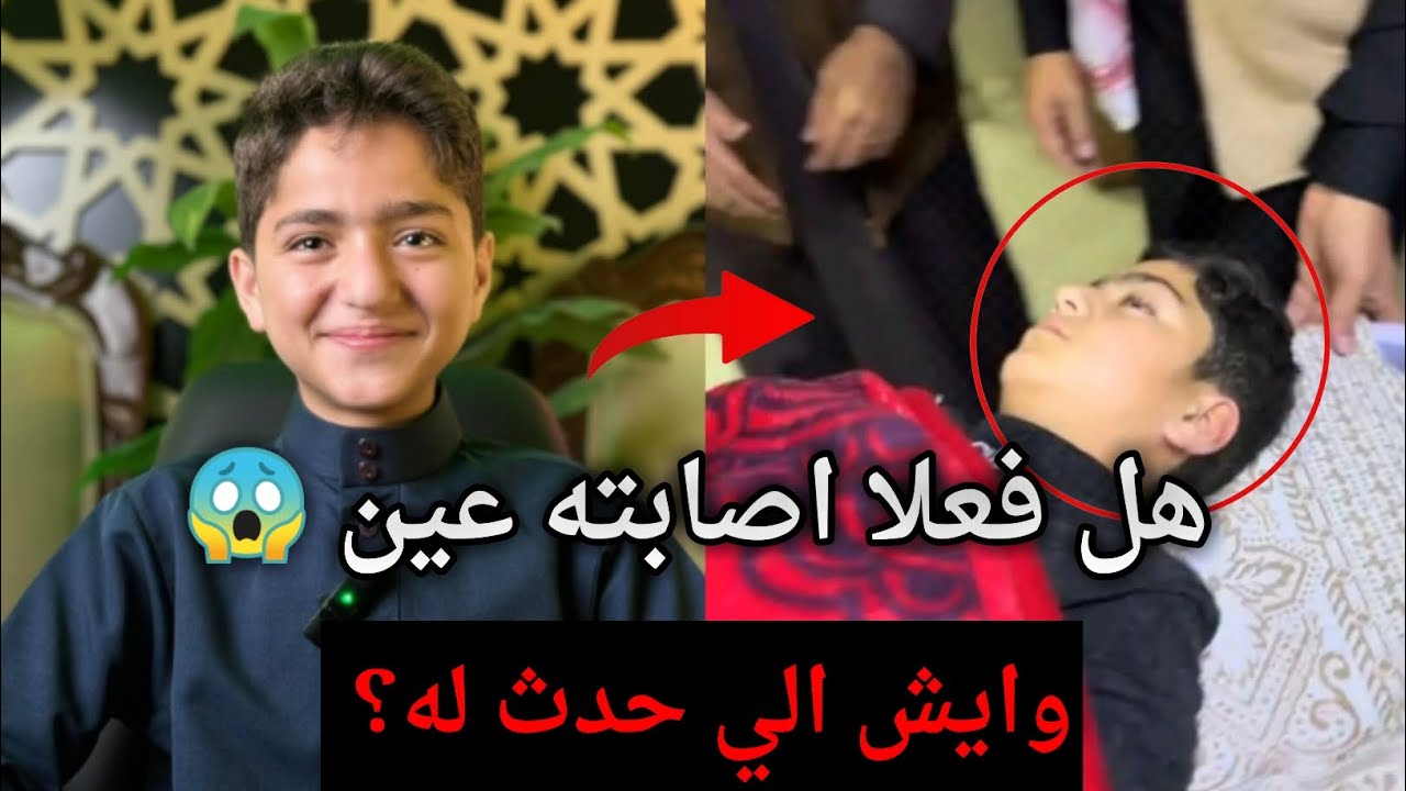 الشاب السوري ابراهيم الحلقي هل فعلا إصابته عين ..وايش الي حدث له؟ 😱