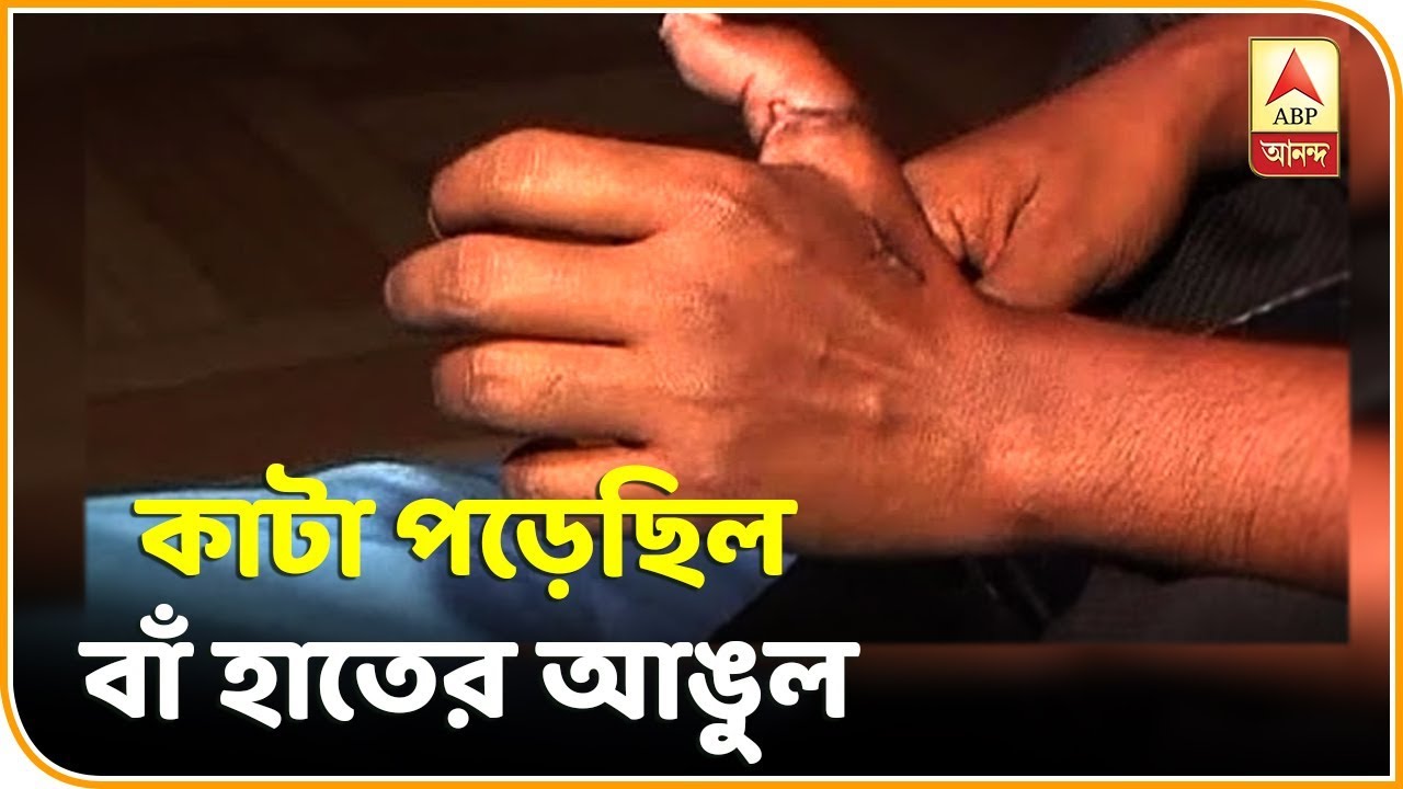 Reporter Stories: medical college finger opporation