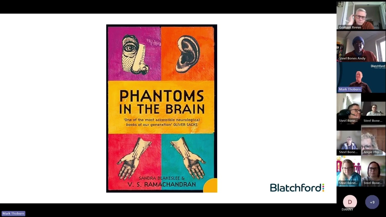 Expert Q & A on Phantom Limb Pain for Amputees