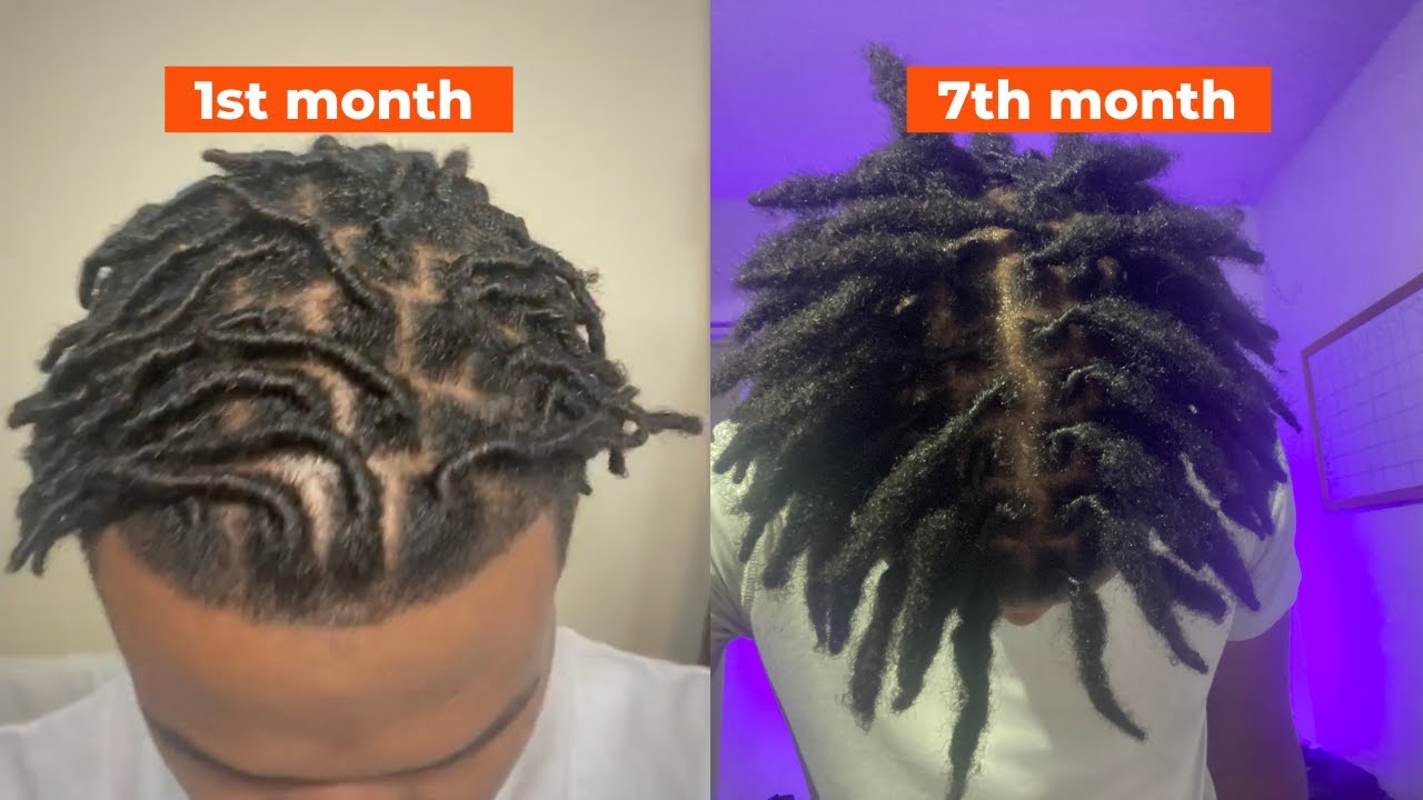 7th months locs/dreads Journey [Update]