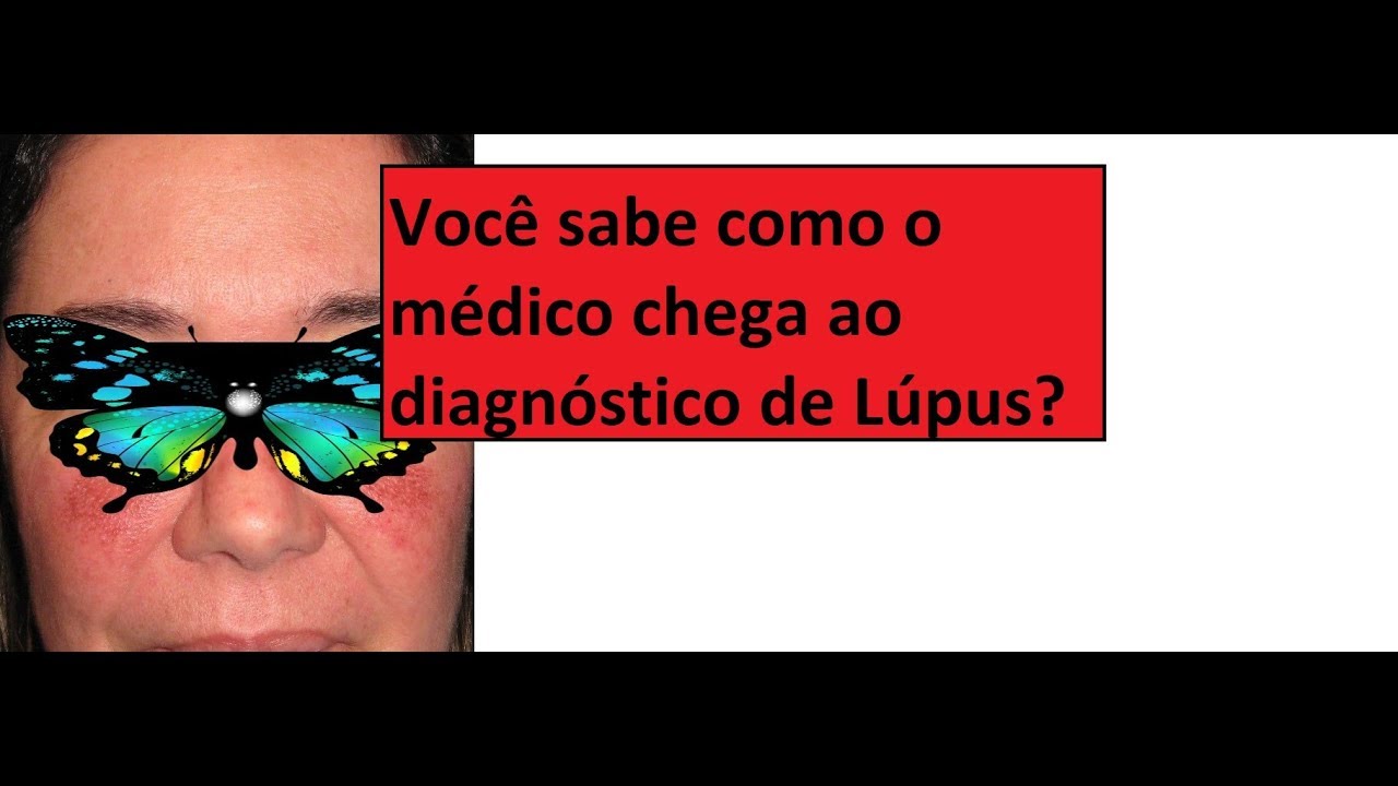 Lúpus: como fazer o diagnóstico exato e o teste de FAN
