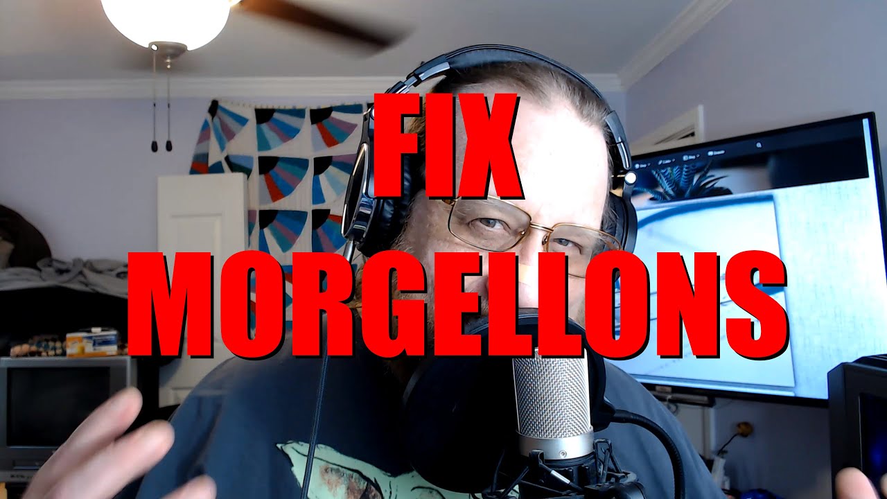 Unbelievable - Fix Morgellons in Just a Single Step! Lyme Disease, Fibro, and VD