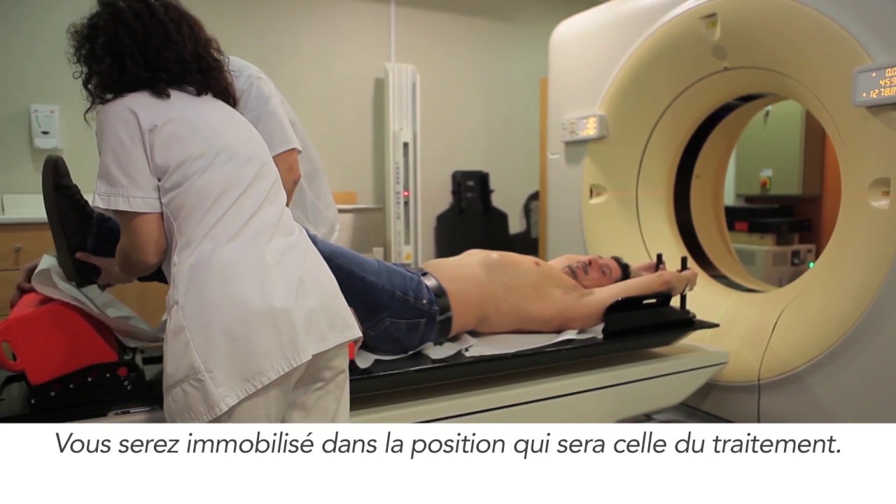 La radiothérapie à l'ICB (Institut de Cancérologie de Bourgogne)