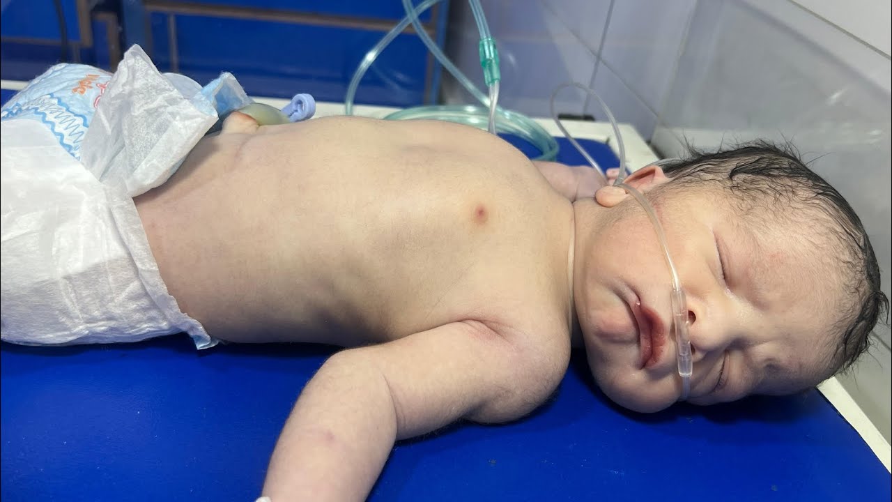 MSL Baby in Critical Condition | A Newborn&rsquo;s Fight for Life