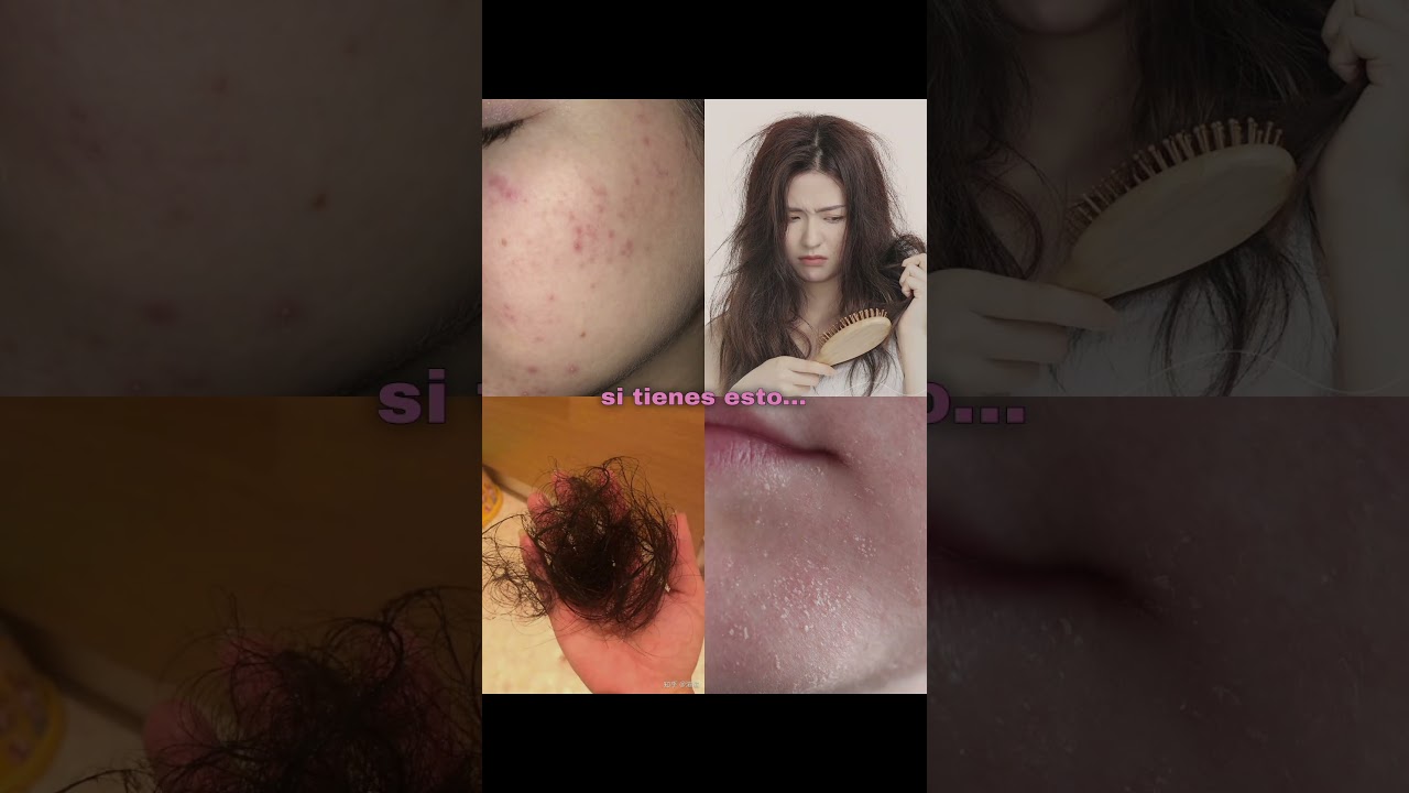 LOS SECRETOS para ACN&Eacute;, PIEL SECA, CA&Iacute;DA de CABELLO y PELO DA&Ntilde;ADO que NADIE TE CUENTA #skincare