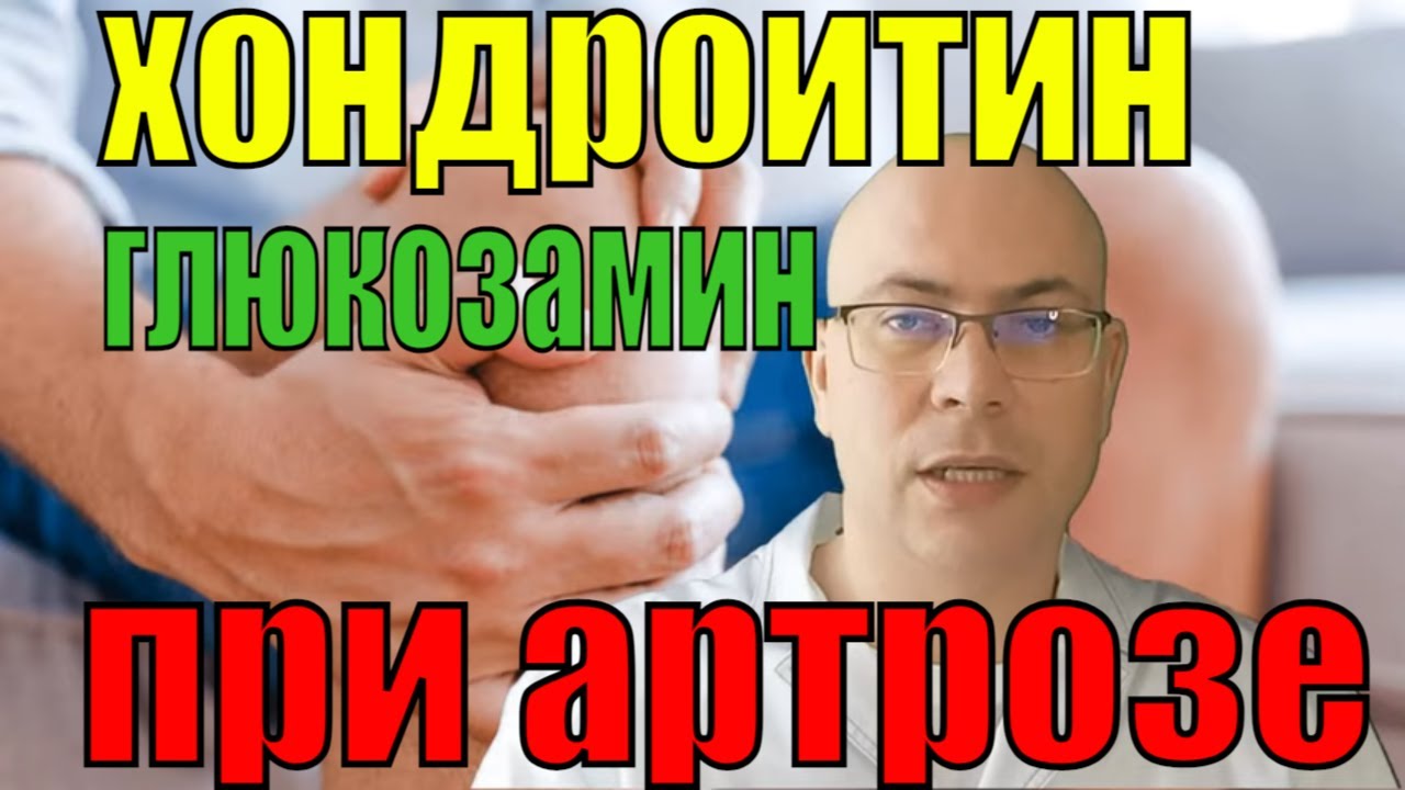 Хондропротекторы хондроитин и глюкозамин при артрозе