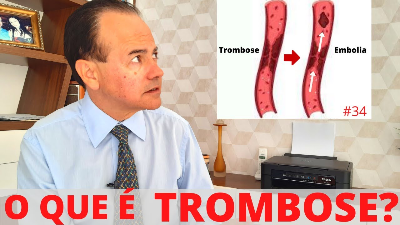 TROMBOSE E EMBOLIA EM CIRURGIA PL&Aacute;STICA | Dr. Jacintho