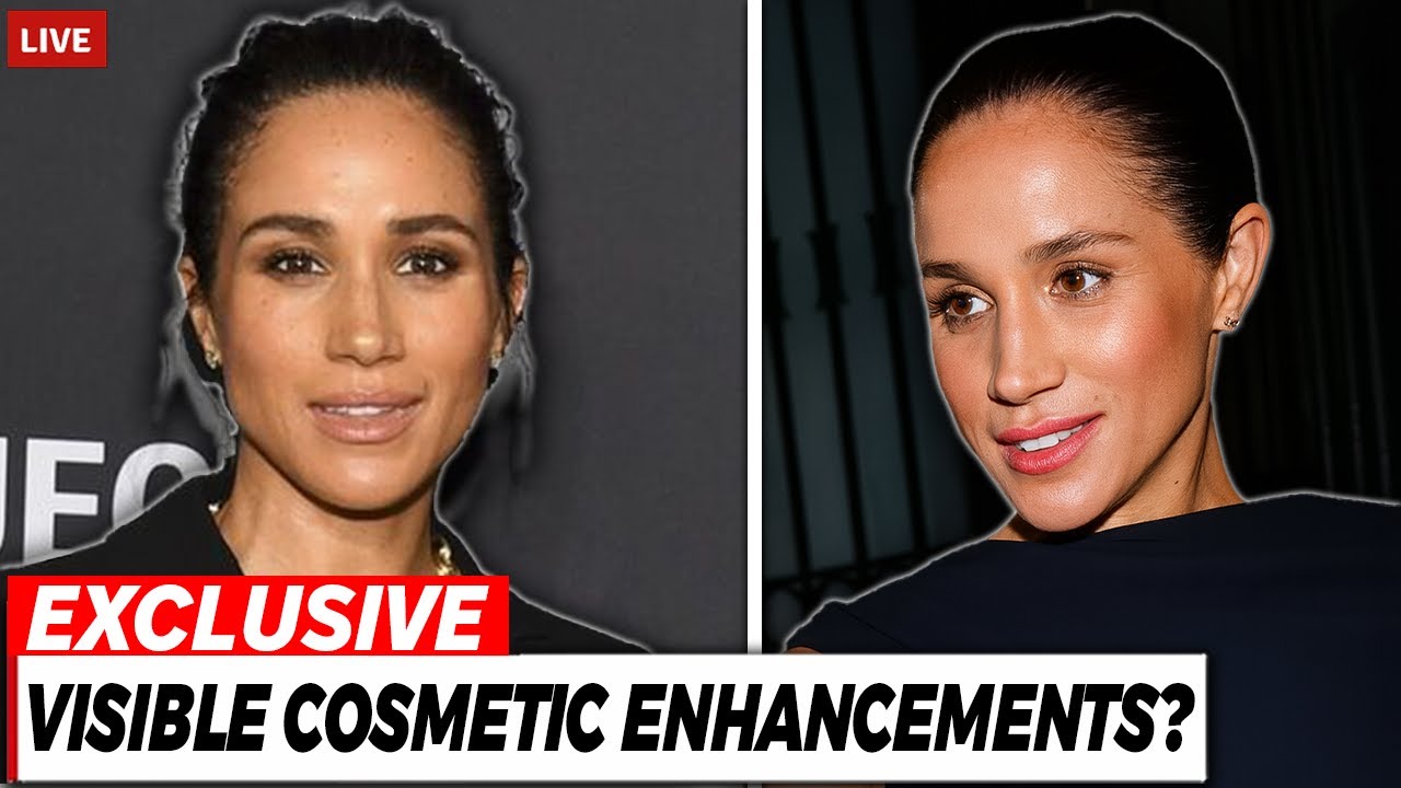Meghan Markle&rsquo;s Dramatic Cosmetic Surgery Revealed in Paris - Facelift, Nose Job & More!