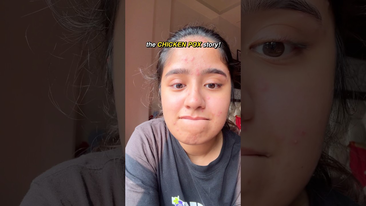 the CHICKEN POX story!🫠🥲 #minivlog #dayinthelifeofamedstudent