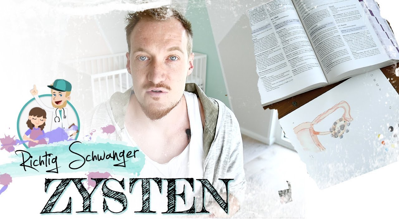 Zysten am Eierstock I ob PCO Syndrom, Endometriose oder funktionell. Zysten gibt es oft