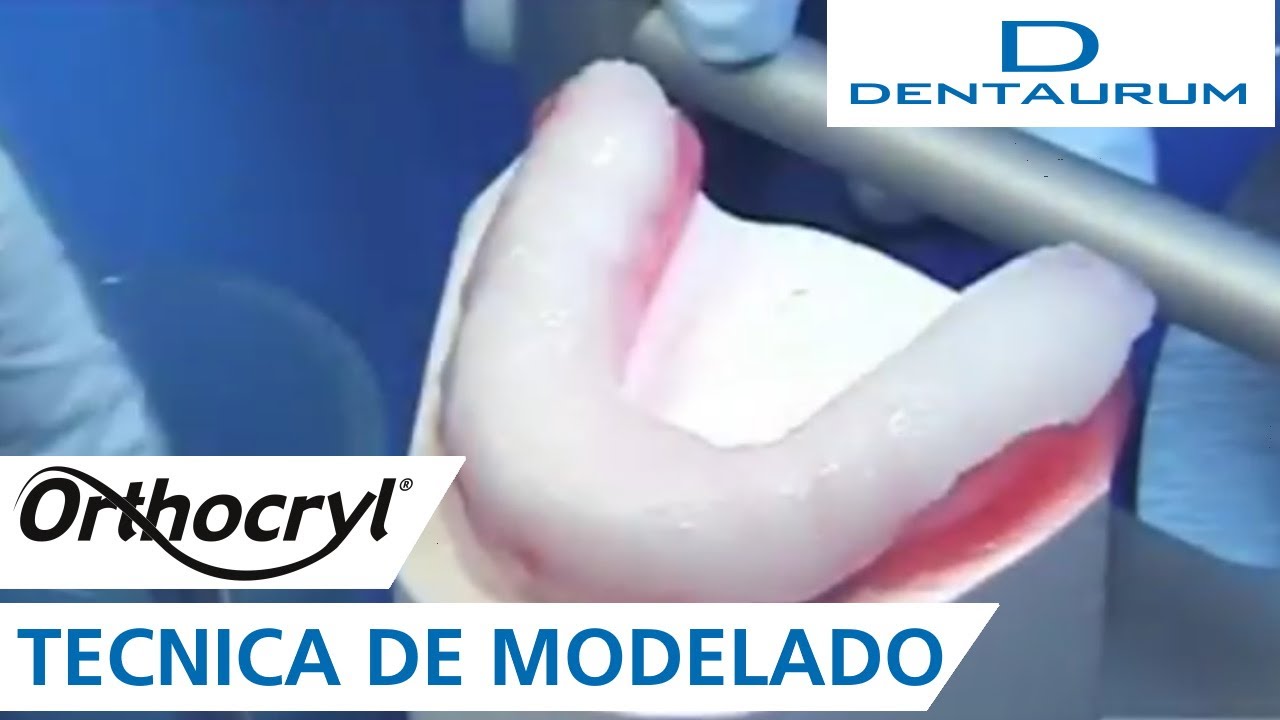 Orthocryl® - férula oclusal con la técnica de modelado (aparatos dentales)