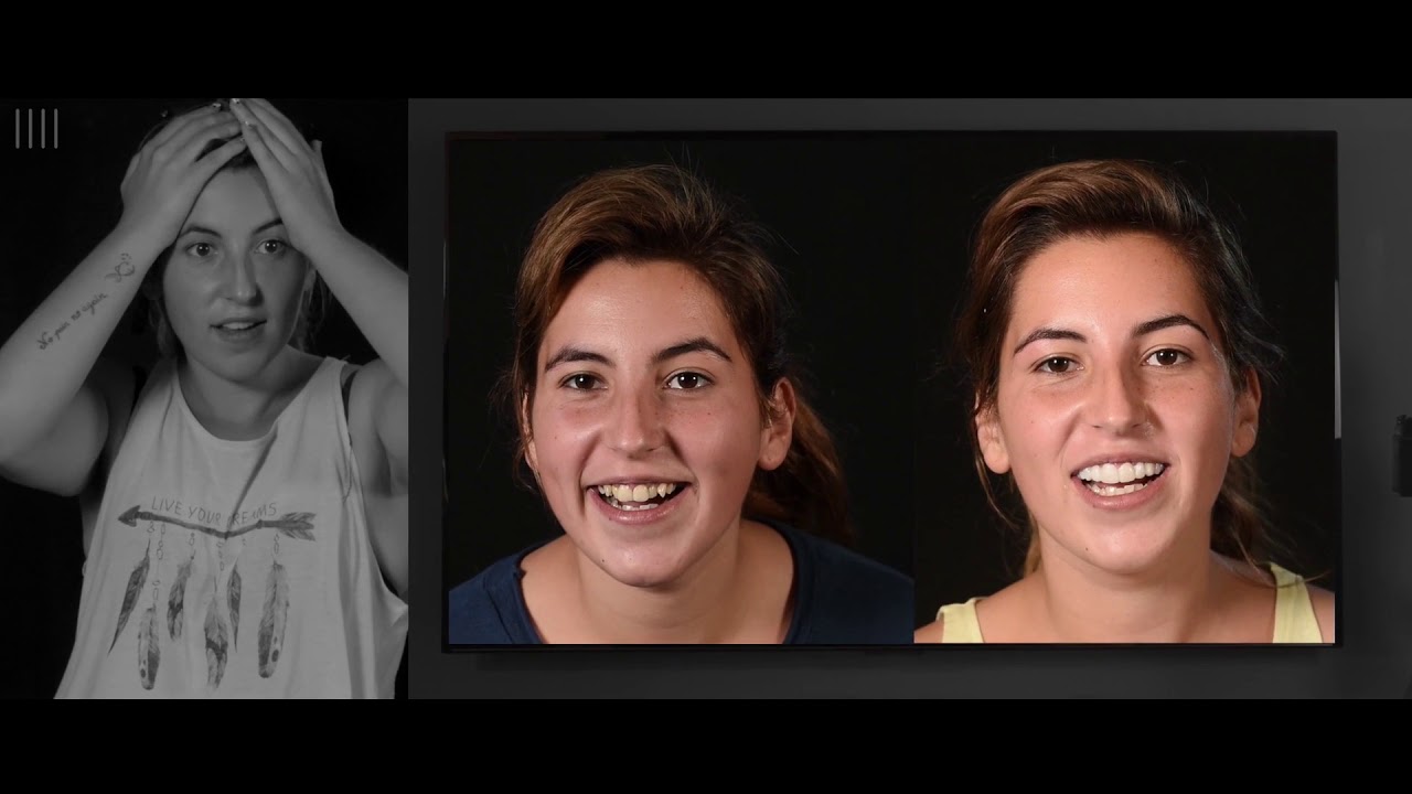 Lifetime Smile Confidence at Smile Stories
