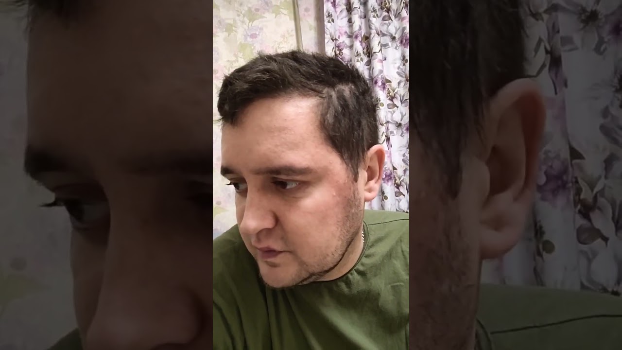 Опять больница!Непереносимость фторуролацила🤒🫩А дальше...39 химий ?